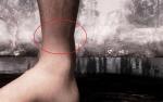post-27796-0-32404000-1445758307_thumb.jpg