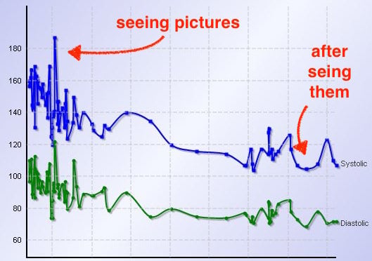 high-blood-pressure-chart.jpg.e08ee2d094956776a08679e9188c6246.jpg
