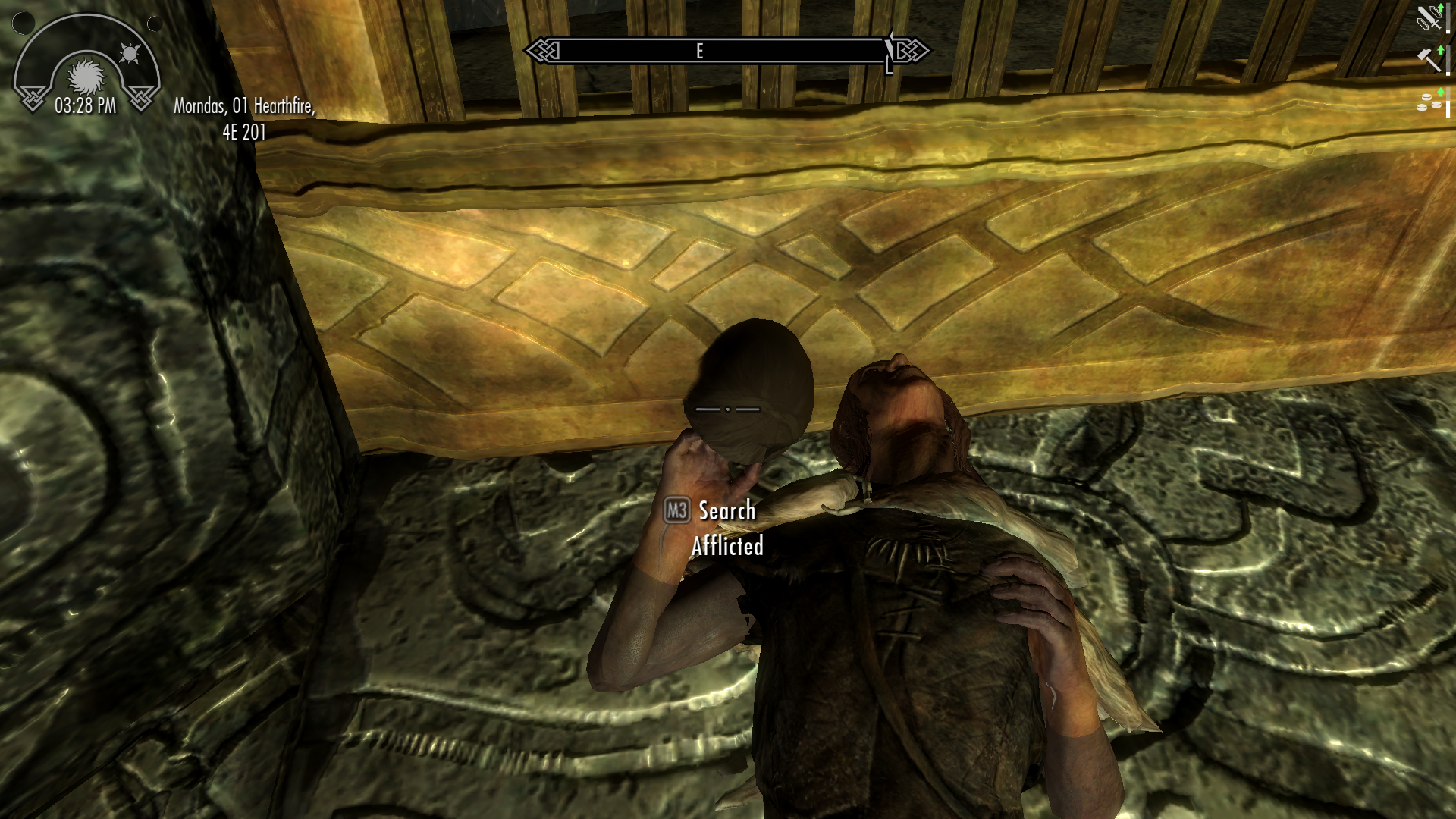 scalp02.png.b859a600a77e5c8302c425c75e255bd7.png