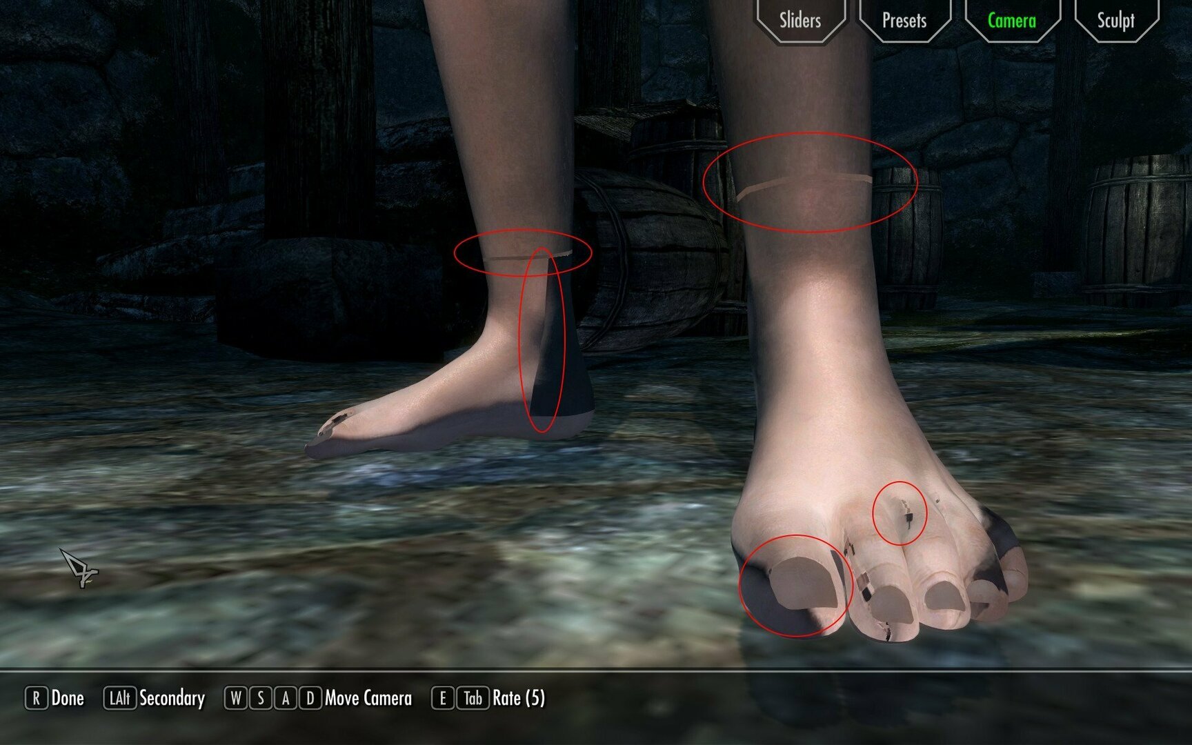 broken-feet.jpg