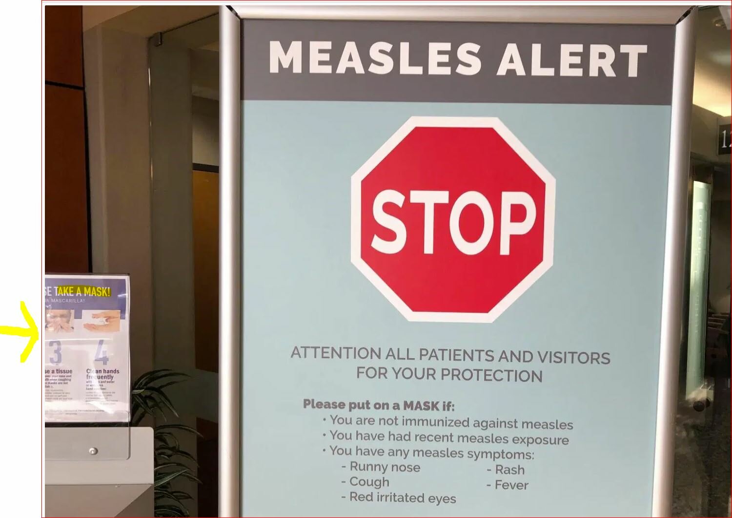 measles.JPG.2a1dc2ee2281921393a4f2f544748c8e.JPG