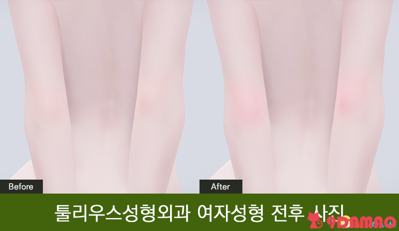 155629jap4hd1jlrnj5hhh.png.6896bdc68bb0ca8cc25138b2340b1db7.png