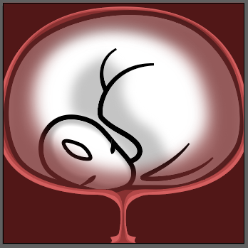 womb_thrombo.png.435002f1471f4869a8888d71734c4202.png