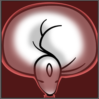 womb_thrombo_birth.png.6e641daf7ba7b10181cac2cfabc9ea38.png