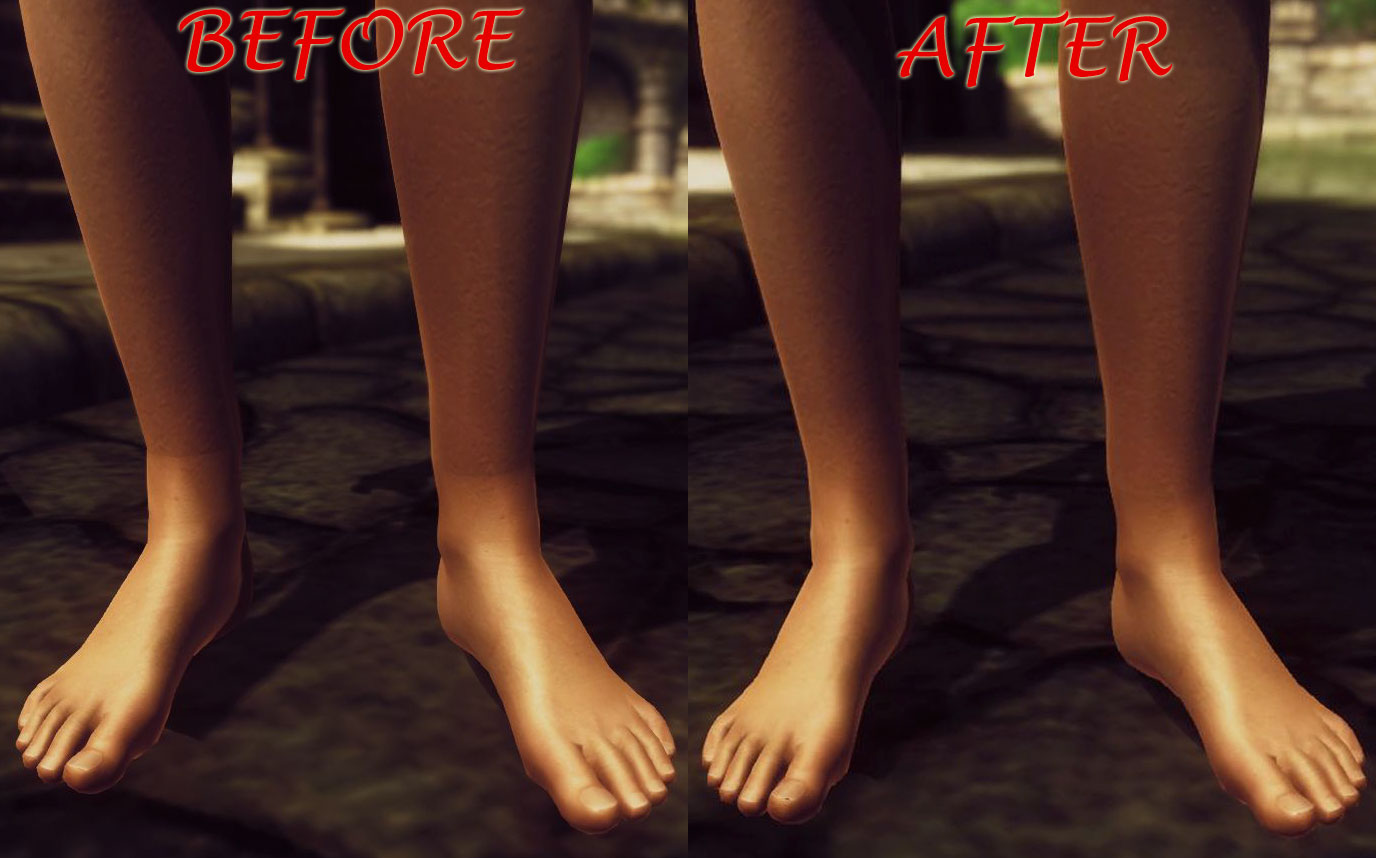 femalefootRTbeforeafter.jpg.aec9816722e6072c0a4926e19cadbd30.jpg