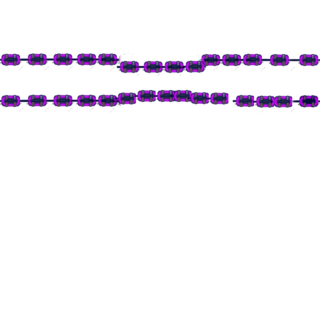 Brackets2.png.aace259d44107189c48740c76ec4dcd0.png