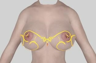 BraNoCover.JPG.7c73d4a24410cc2ed328cd3de2895622.JPG