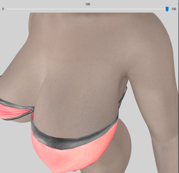 ThinBraAfter.png.184c26cb32ab6dfe71ffff16d8148d97.png