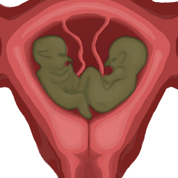 Fetus_GBDefault03_Multiplet_2.png.07efa41b29f0756e8b6d82fb167697c1.png