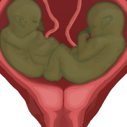 Fetus_GBDefault04_Multiplet_2.png.5b0b2445b422d922de4760c691591df5.png