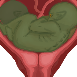 Fetus_GBDefault05_Multiplet_2.png.421a74904a5d71f71c7a458ecb9dcf33.png