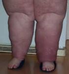 post-1130761-0-03761900-1480289383_thumb.jpg