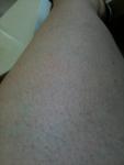post-2468211-0-13361500-1509892206_thumb.jpg