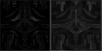 post-248631-0-08995400-1484001001_thumb.png