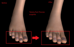 post-781013-0-91212900-1472695531_thumb.png